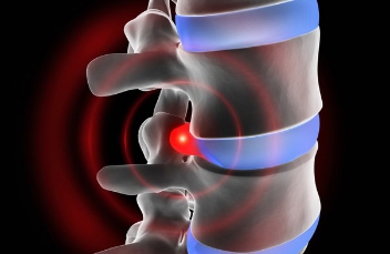 Лечение протрузии или когда нужно обращаться к врачу?