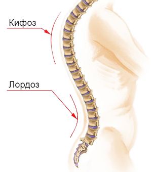 Грудной кифоз и поясничный лордоз позвоночника.