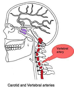 Шейный отдел позвоночника и вертебро-базиллярная недостаточность.